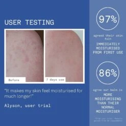 Ultra Caring Body Balm For Dry, Sensitive & Eczema-Prone Skin 250ml -Babyliss Care Shop ultra caring body balm for dry sensitive eczema prone skin 250ml p31145 84207 image